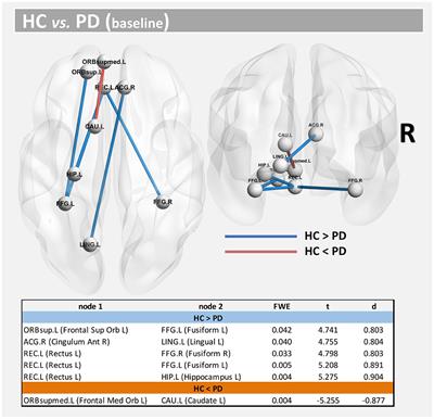 Structural connectivity and brain network analyses in Parkinson's disease: A cross-sectional and longitudinal study